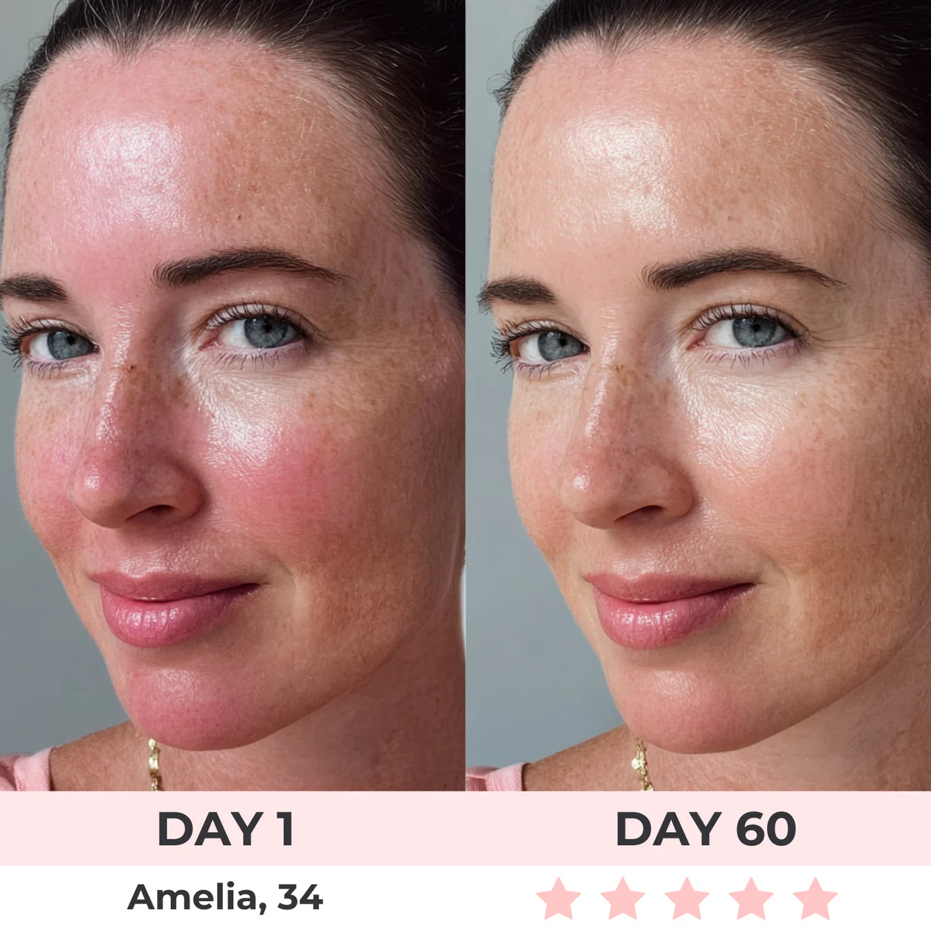 Glowsy™ 7-Color LED Facial Mask