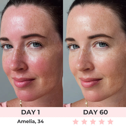 Glowsy™ 7-Color LED Facial Mask